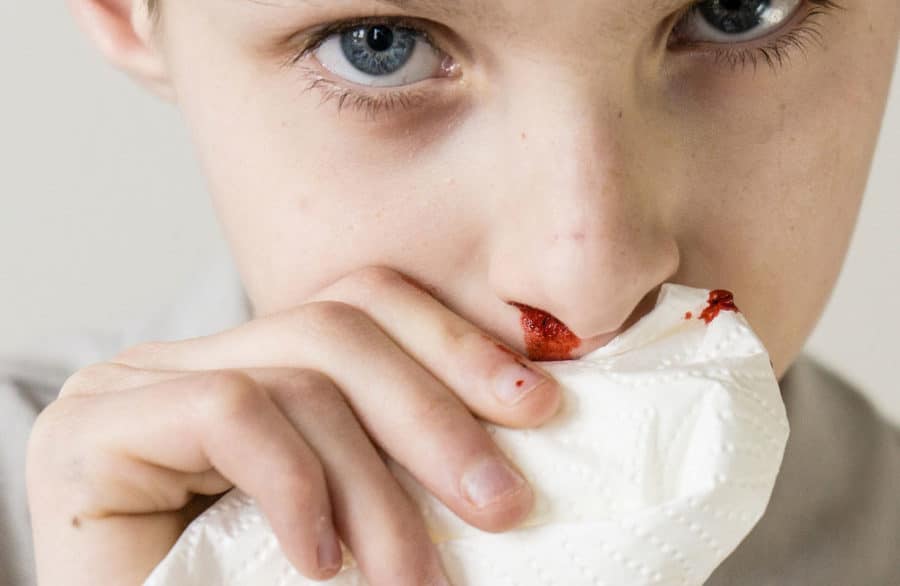 Nasenbluten beim Kind